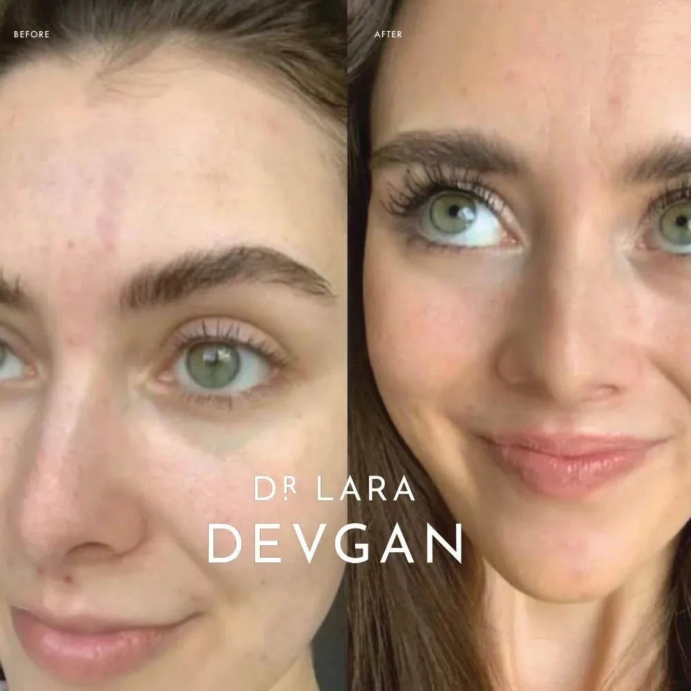 DR DEVGAN PLATINUM LONG LASH SERUM SCIENTIFIC BEAUTY VEGAN BEST MOST RESULTS NWT - Picture 11 of 14